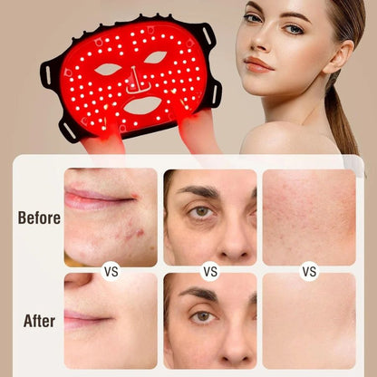 TONE & TOWEL LUXE™ Pro Max LED Therapy Mask